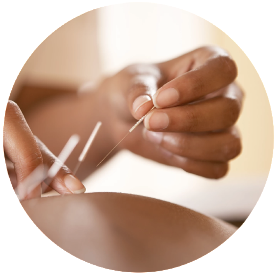 person's hand doing acupuncture in toronto naturopathic treatments and services